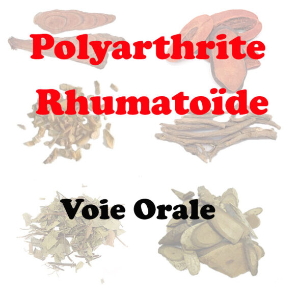 Polyarthrite Rhumatoïde